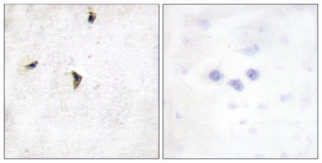 Anti-KV2.1 antibody produced in rabbit