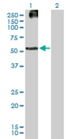 Anti-KRTHB3 antibody produced in mouse