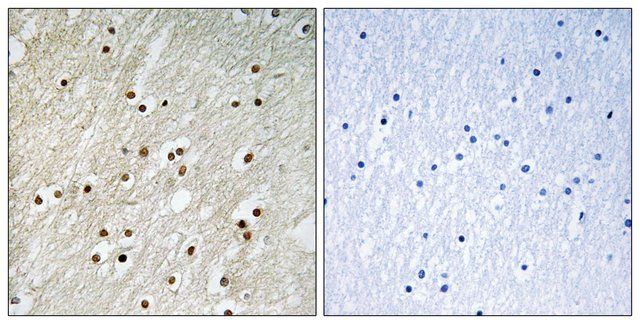 Anti-Ku70 antibody produced in rabbit