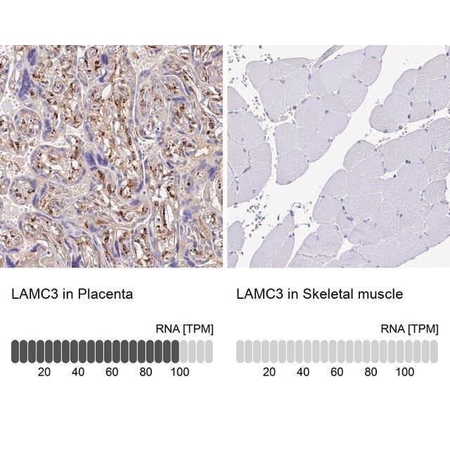 Anti-LAMC3 antibody produced in rabbit