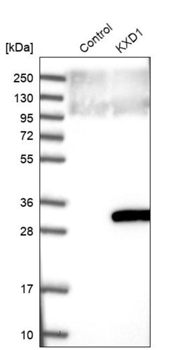 Anti-KXD1 antibody produced in rabbit