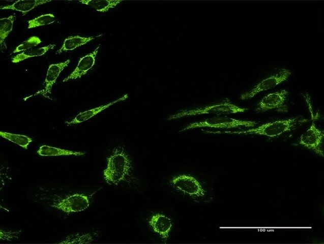 Anti-HSPD1 antibody produced in rabbit