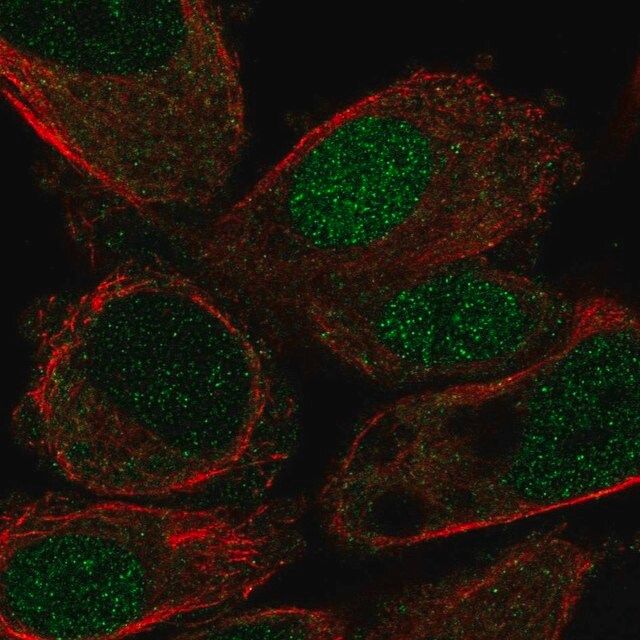 Anti-HLF antibody produced in rabbit