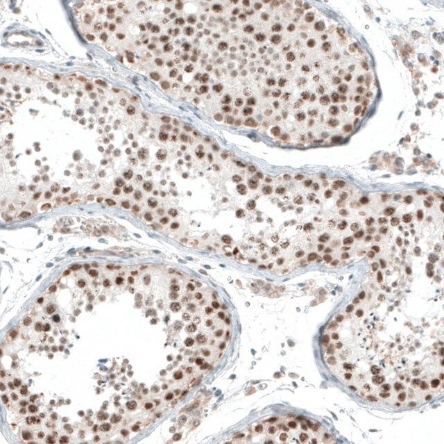 Anti-HLTF antibody produced in rabbit