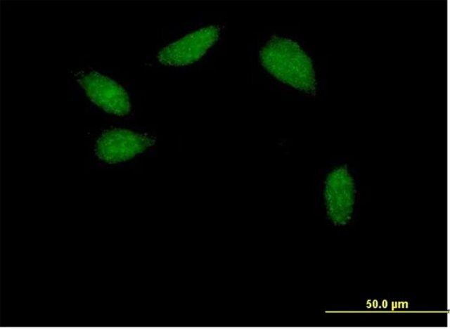 Anti-HNF1B antibody produced in mouse