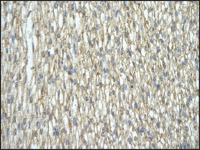 Anti-HNRNPA2B1 antibody produced in rabbit