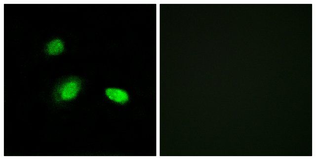 Anti-HSPB2 antibody produced in rabbit