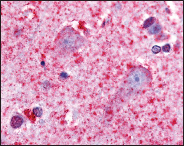 Anti-HTR7 (AB1) antibody produced in rabbit