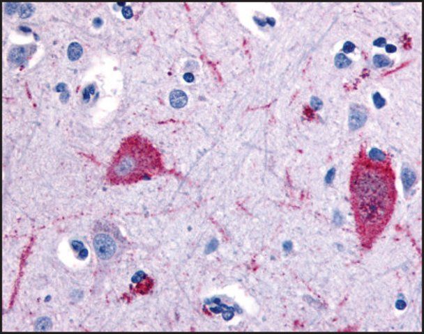 Anti-HTR5A (AB1) antibody produced in rabbit