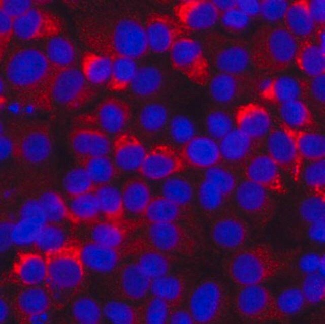 Anti-Hepatitis C Virus Antibody, helicase domain NS3