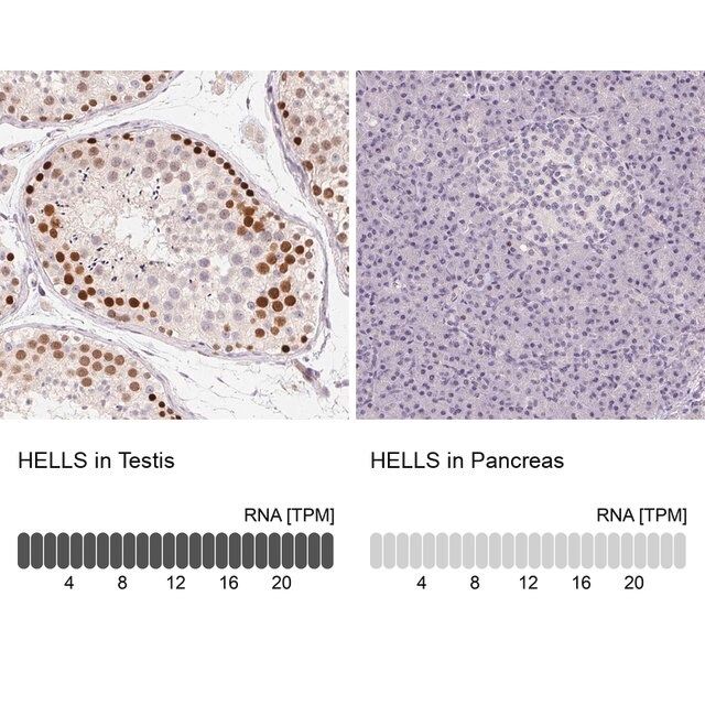 Anti-HELLS antibody produced in rabbit