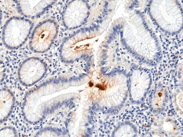 Anti-<i>Helicobacter Pylori</i> (H.Pylori) Rabbit Monoclonal Antibody