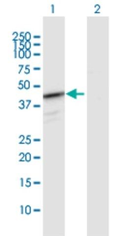 Anti-HEMK1 antibody produced in rabbit