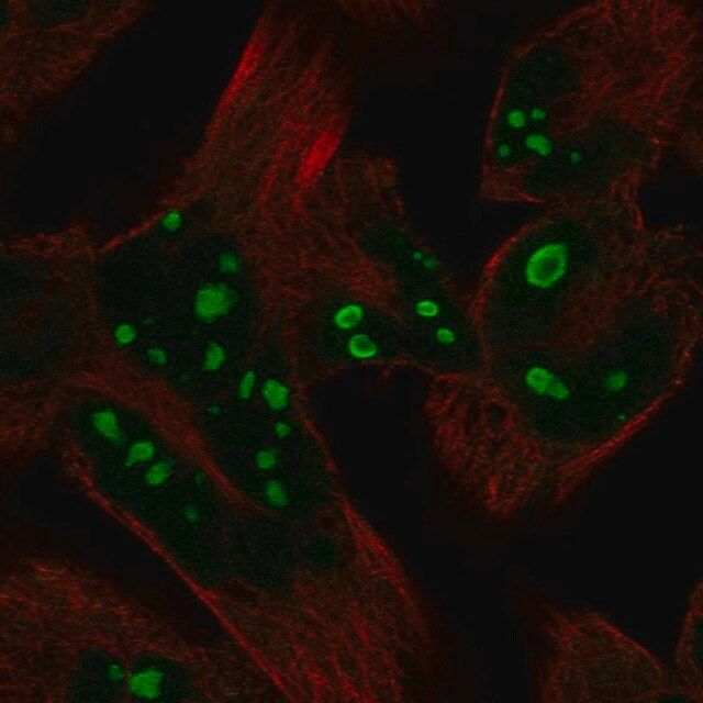 Anti-HERPUD2 antibody produced in rabbit