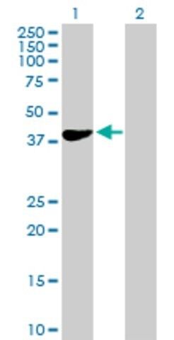 Anti-HEMK1 antibody produced in mouse