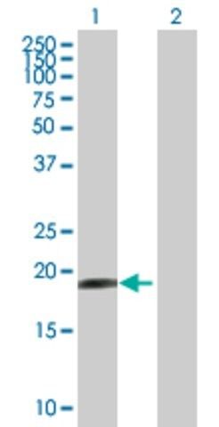 Anti-HESX1 antibody produced in mouse