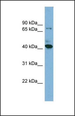 Anti-HERPUD2, (N-terminal) antibody produced in rabbit