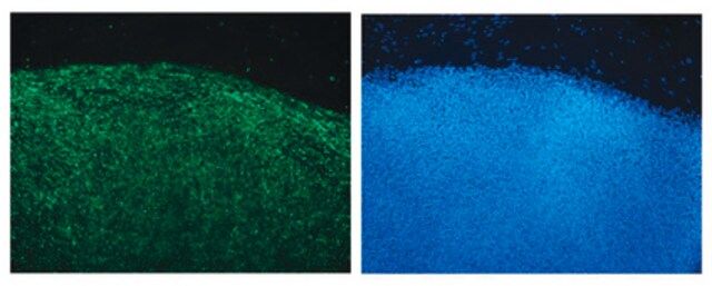 Anti-HESCA-1 Antibody, clone 051007-4A5