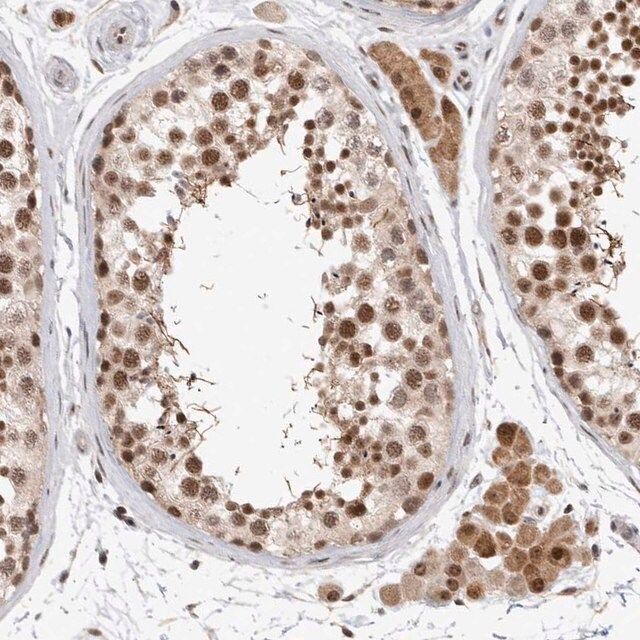 Anti-HESX1 antibody produced in rabbit