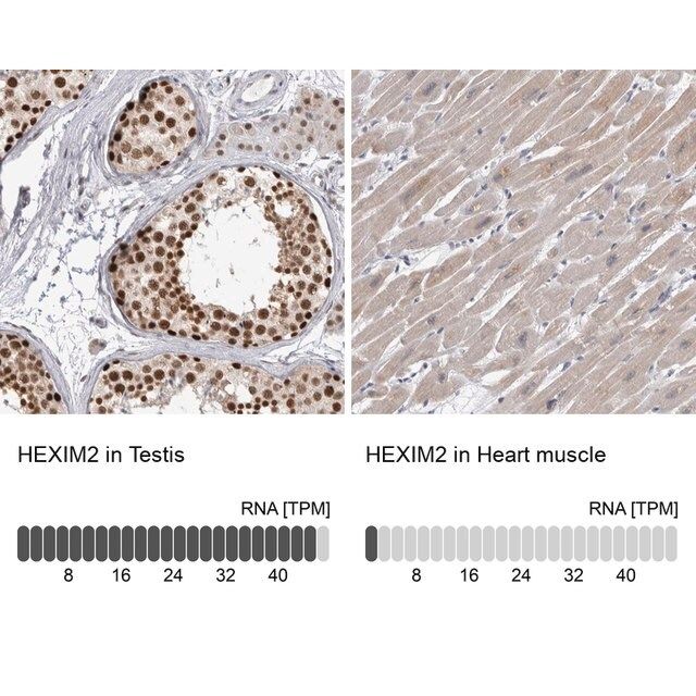 Anti-HEXIM2 antibody produced in rabbit