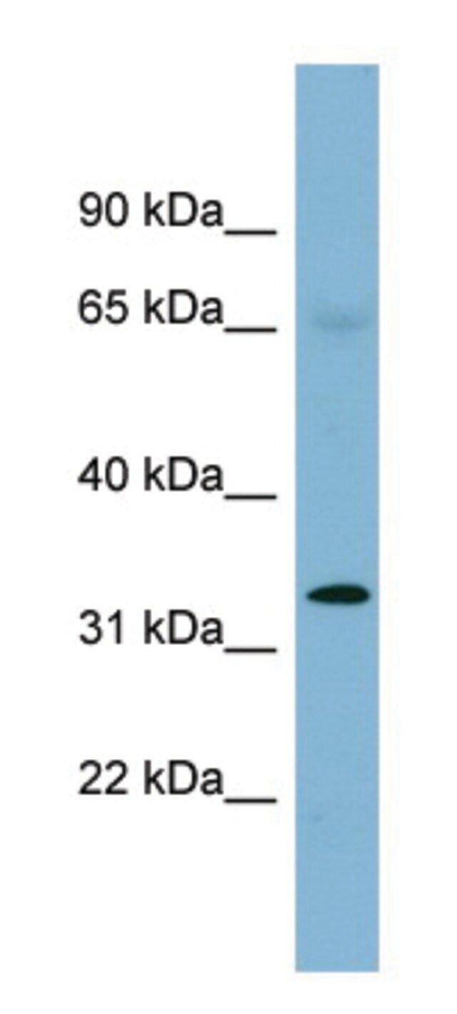 Anti-HEY1 antibody produced in rabbit