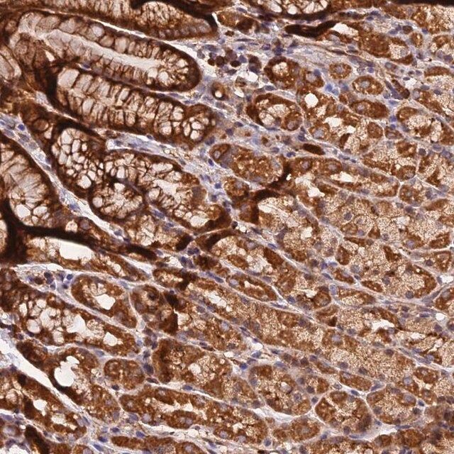 Anti-HERPUD1 antibody produced in rabbit