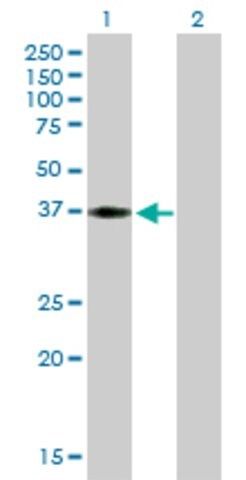 Anti-HEY2 antibody produced in mouse