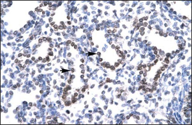 Anti-HEY1 antibody produced in rabbit