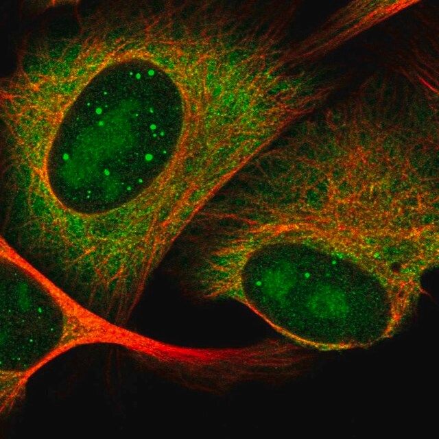 Anti-HES6 antibody produced in rabbit