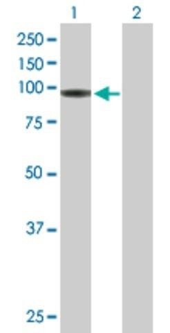 Anti-HLCS antibody produced in mouse