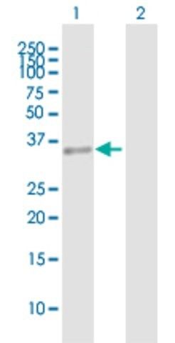 Anti-HLRC1 antibody produced in mouse