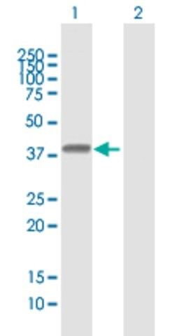 Anti-HLA-E antibody produced in mouse