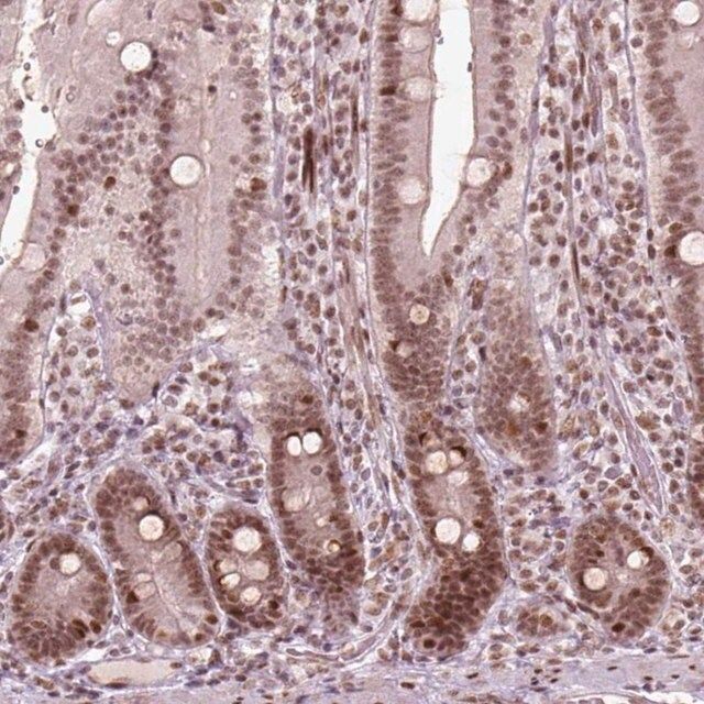 Anti-HMG20B antibody produced in rabbit