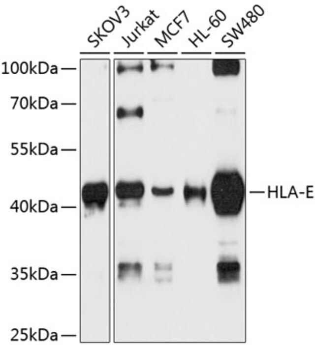 Anti-HLA-E antibody produced in rabbit