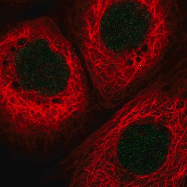 Anti-HLTF antibody produced in rabbit