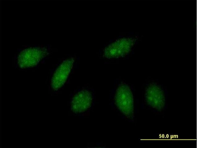 Anti-HLX antibody produced in mouse