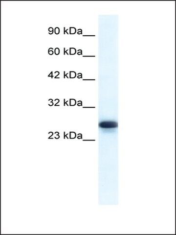 Anti-HMGB1