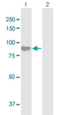 Anti-HLCS antibody produced in rabbit