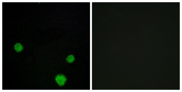 Anti-HLX1 antibody produced in rabbit