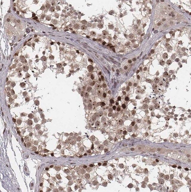 Anti-HMGA2 antibody produced in rabbit