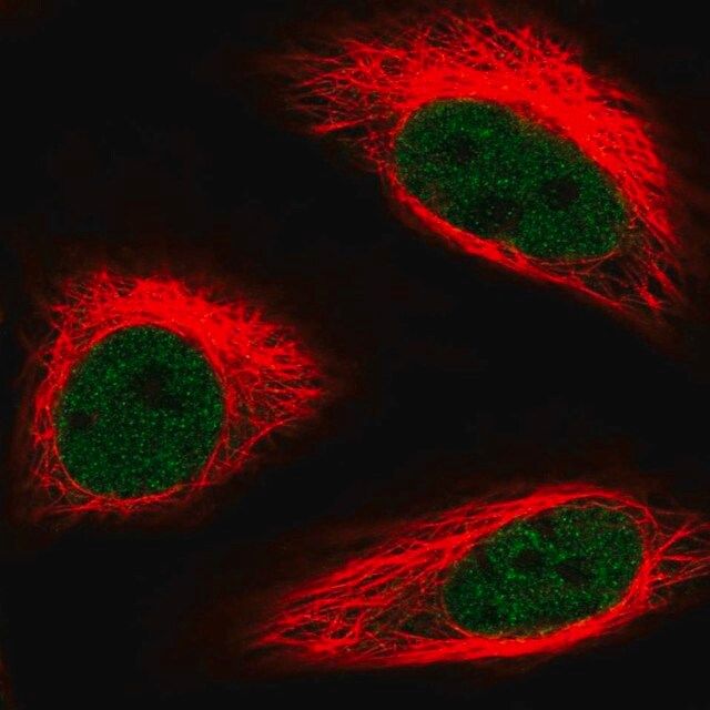 Anti-HMG20B antibody produced in rabbit