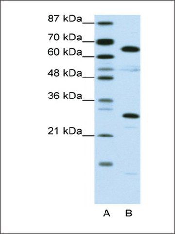 Anti-HMGB4 antibody produced in rabbit