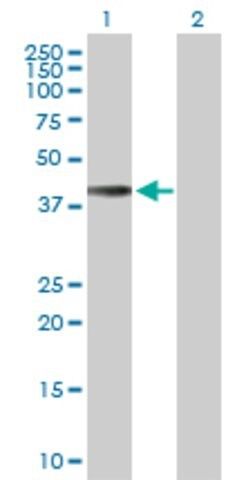 Anti-HLA-E antibody produced in rabbit