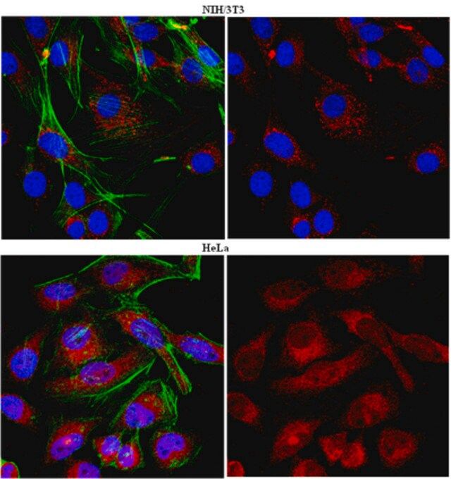 Anti-HAX-1 Antibody