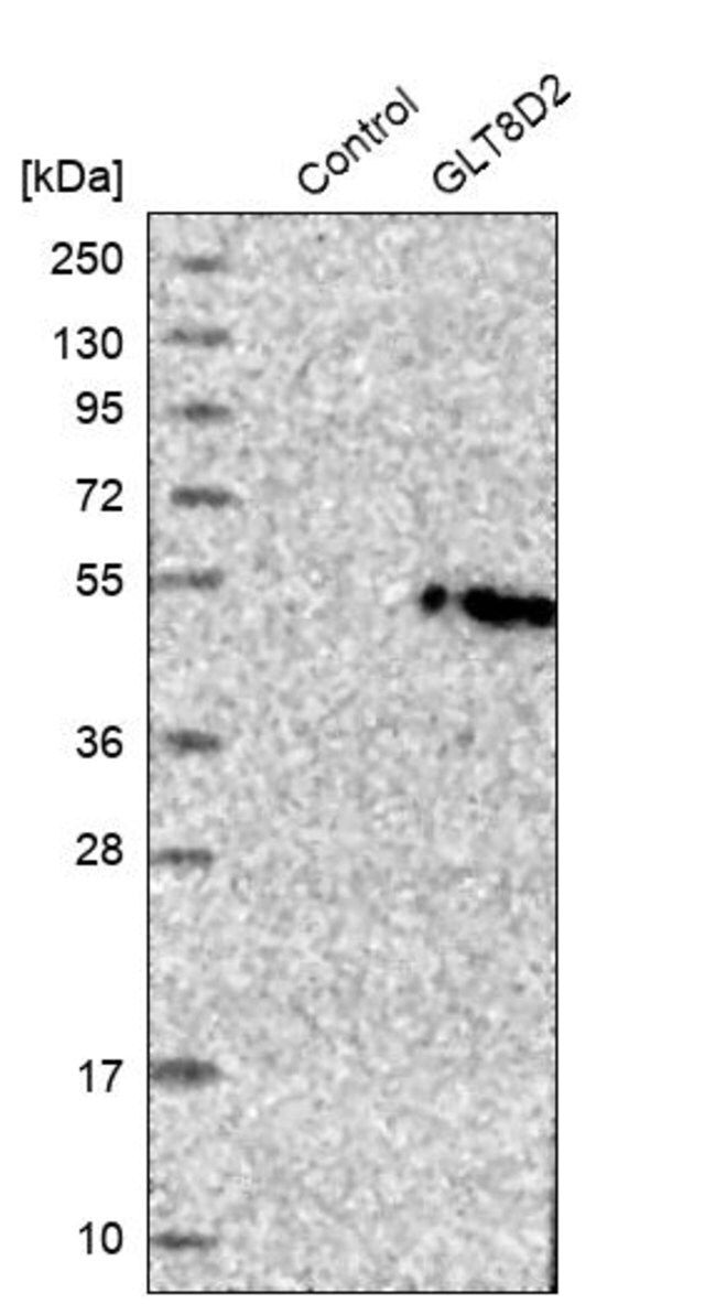 Anti-GLT8D2 antibody produced in rabbit