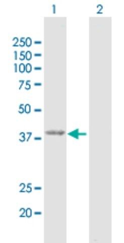 Anti-GMDS antibody produced in rabbit