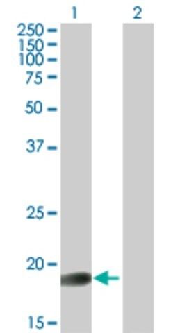 Anti-GLYAT antibody produced in mouse