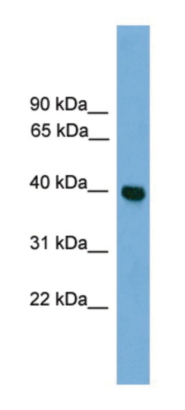 Anti-GNAI3 antibody produced in rabbit