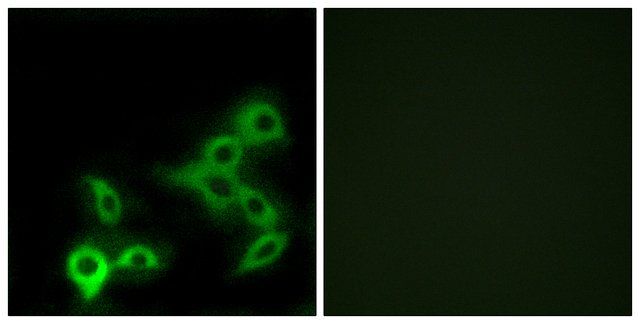 Anti-GPBAR antibody produced in rabbit