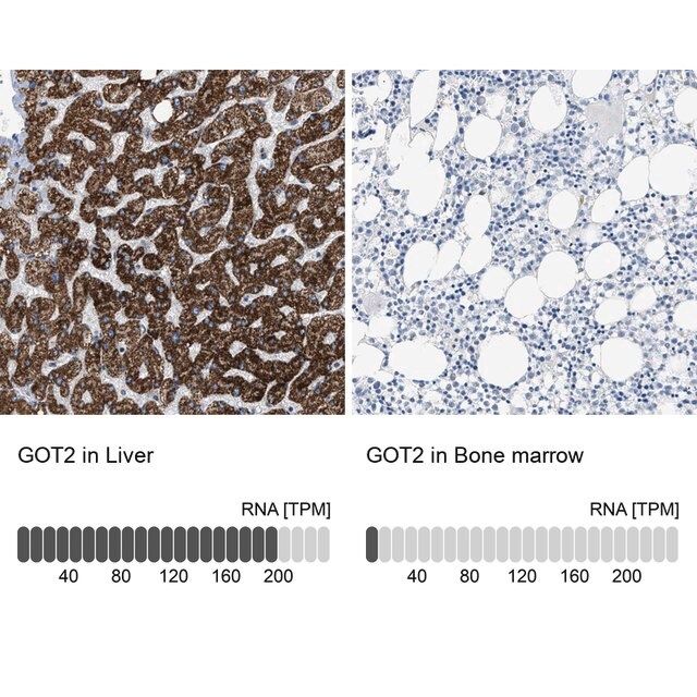 Anti-GOT2 antibody produced in rabbit